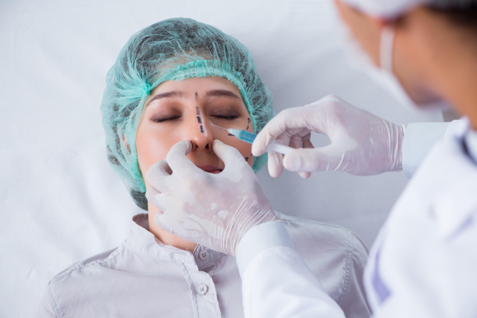 Rhinoplasty in Hyderabad